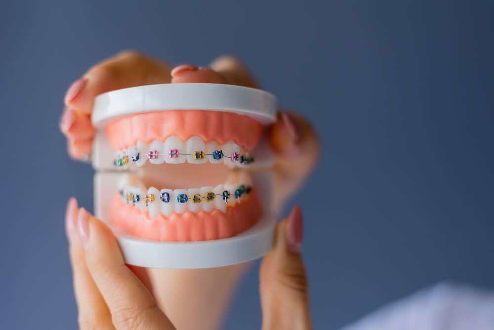 mock-up of a dental jaw with braces on a gray background, space for text