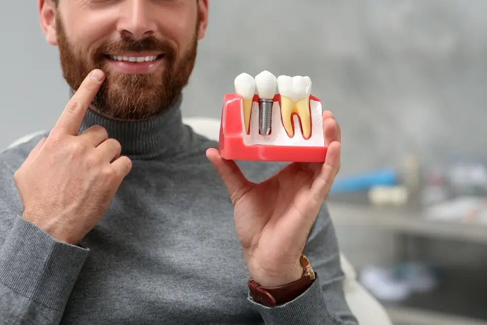Man holding educational model of dental implant on blurred background, closeup. Space for text

