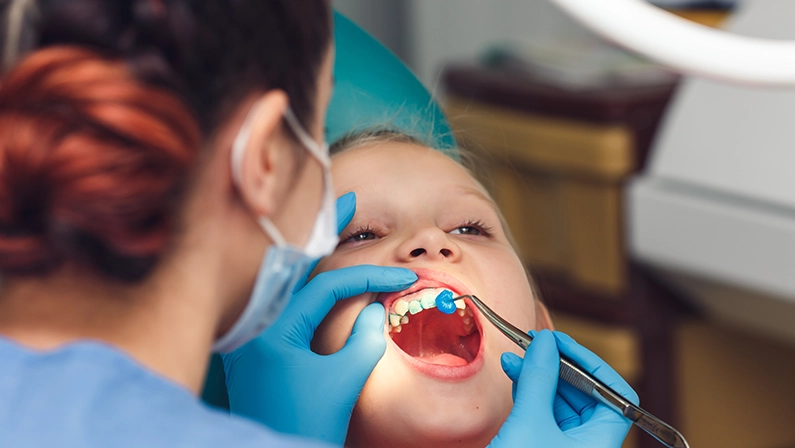 dentist fluoridates a child's teeth. Strengthening of tooth enamel.