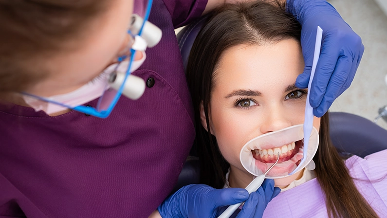 Dentist in gloves places temporary dental filling with instrument in clinic. Dental professional fills tooth space with filling composition