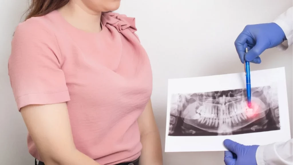 The doctor holds a panoramic X-ray picture of the patient's teeth