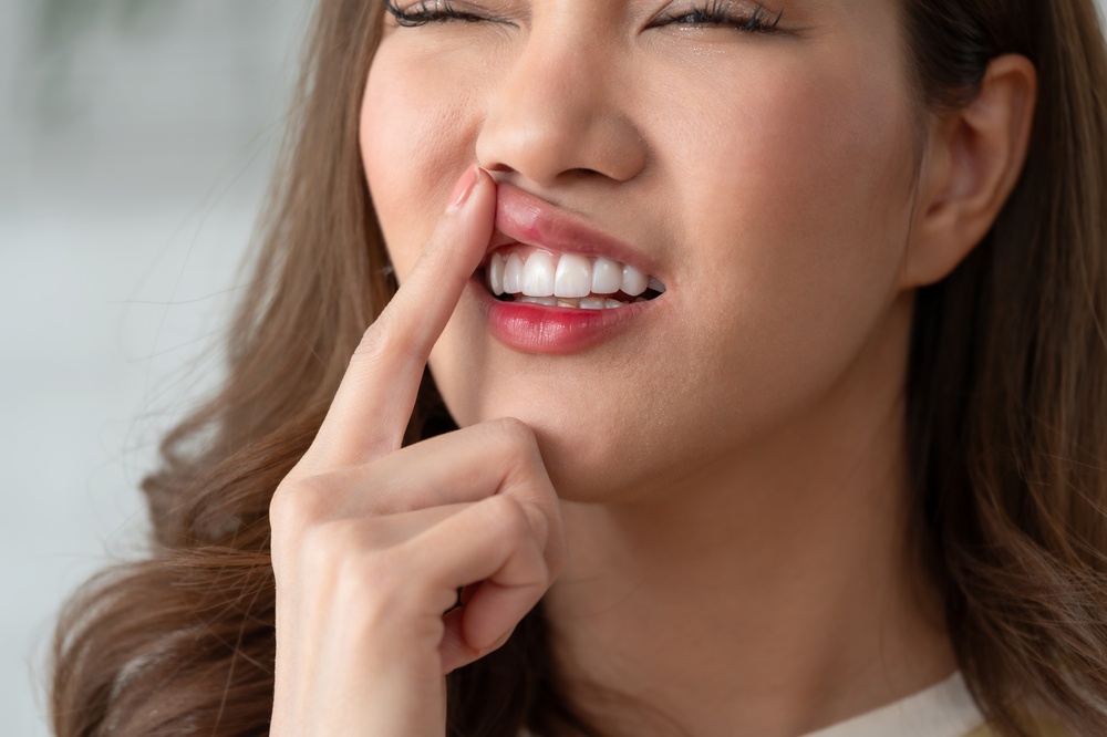 Woman lifting her upper lip with her finger to reveal a red inflamed sore on her gums