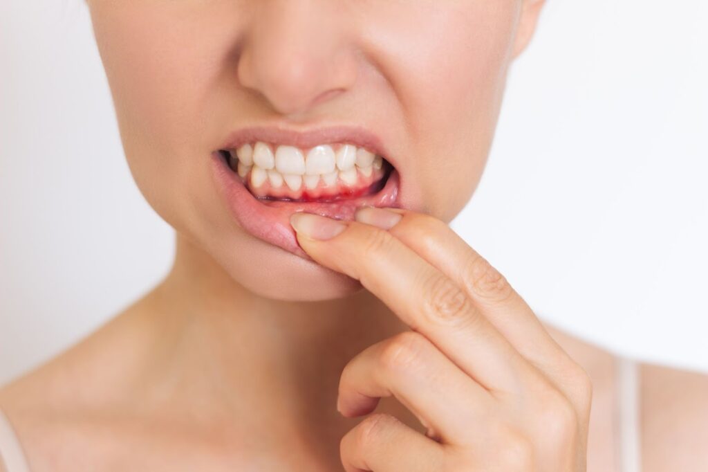 gum health