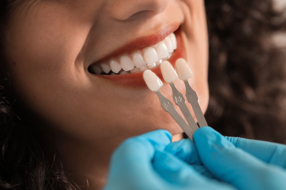 Doctor checking young woman's teeth color, closeup